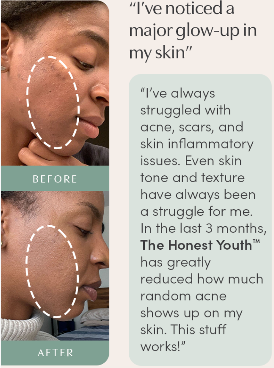 The Honest Youth™ - skin & anti-aging ingestible tincture