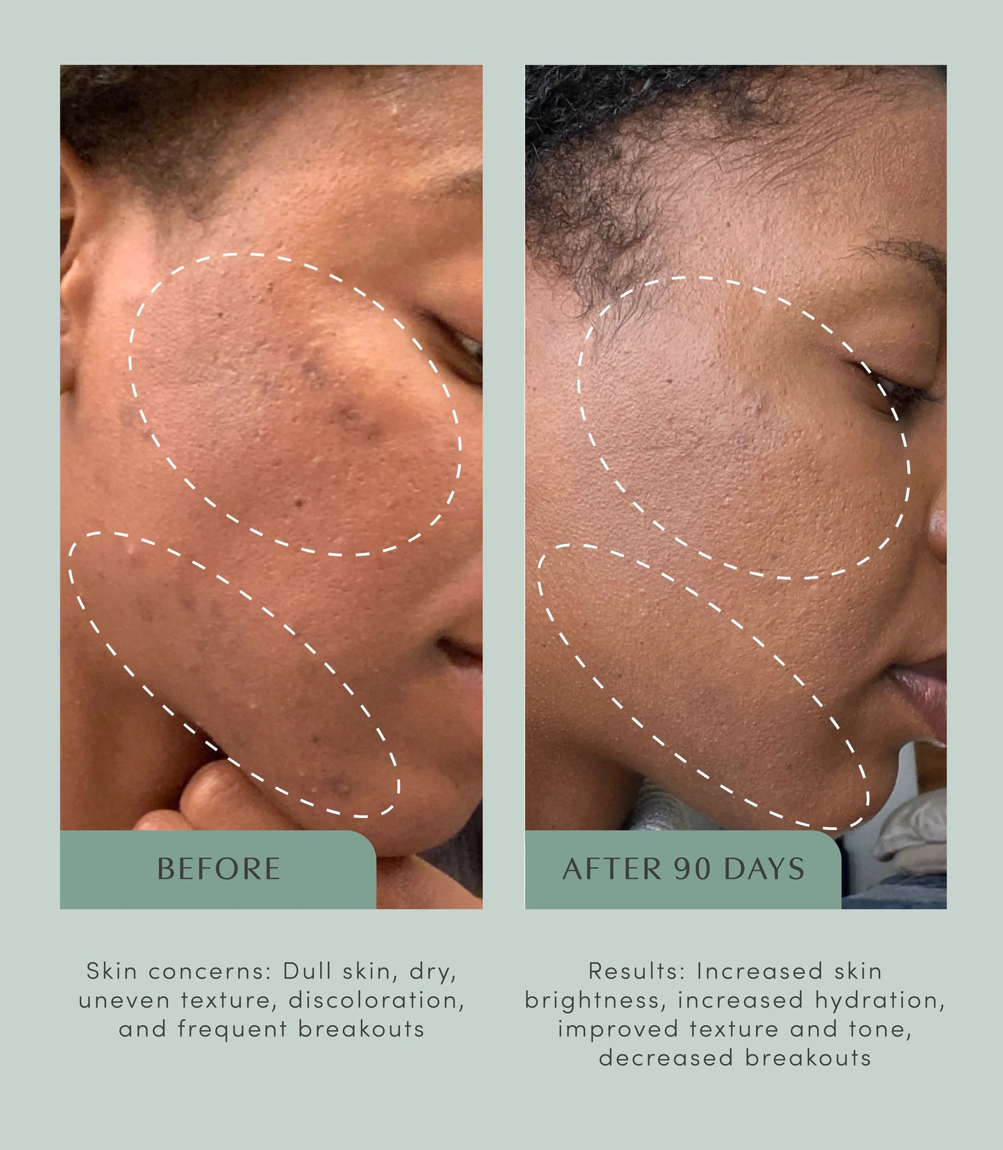 The Honest Youth™ - skin & anti-aging ingestible tincture